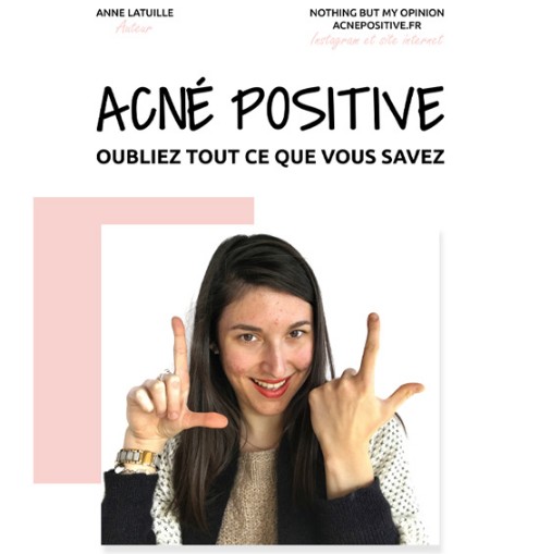 Ebook Acné Positive Nothing But My Opinion